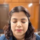 chemical-peel