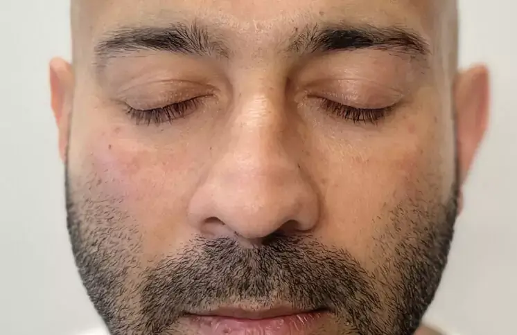 under-eye-dark