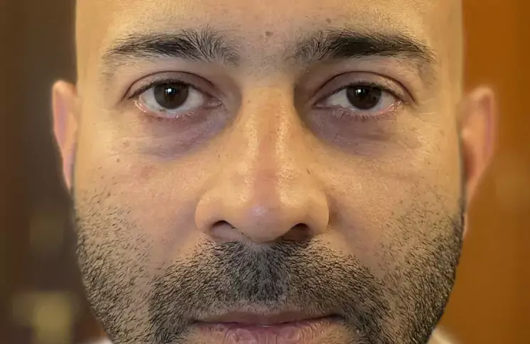 under-eye-dark